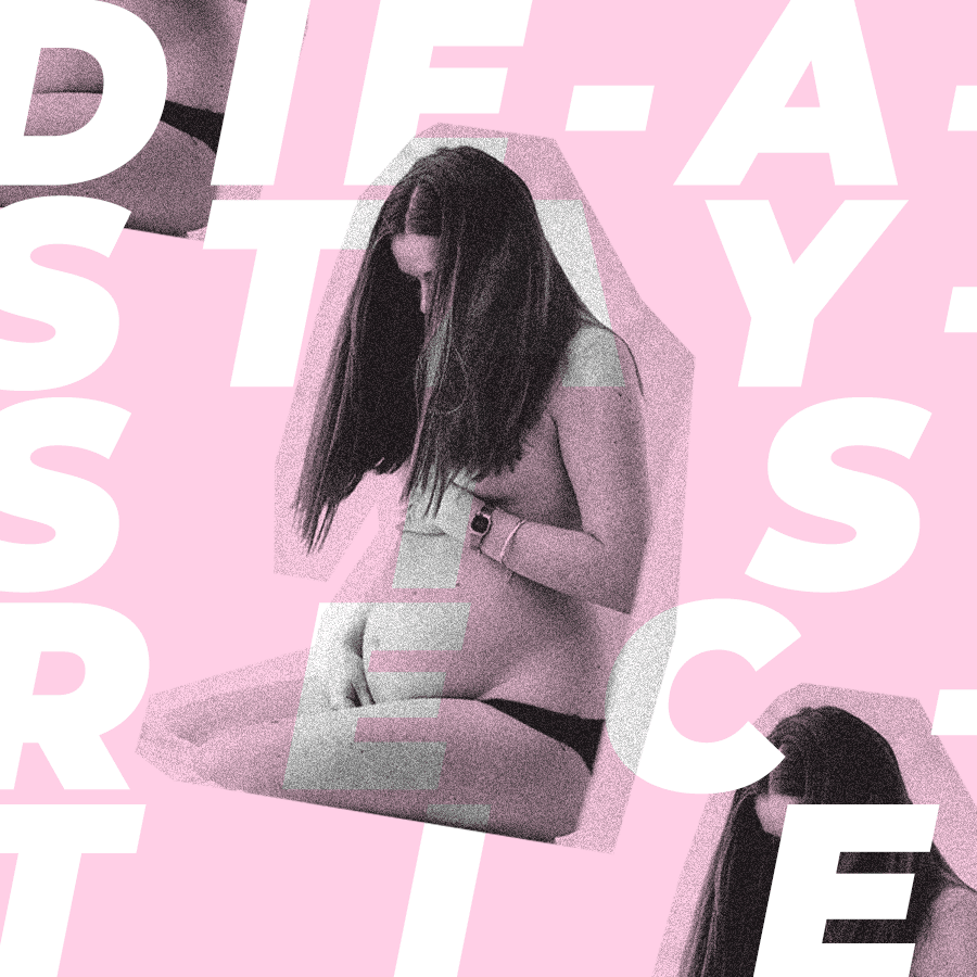 What Is Diastasis Recti And How Do I Check If I Have It?